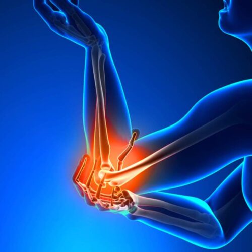 Elbow pain: Diet, Exercise, symptoms, treatment, and more - sharpmuscle