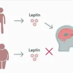 Leptin resistance - Sharp Muscle